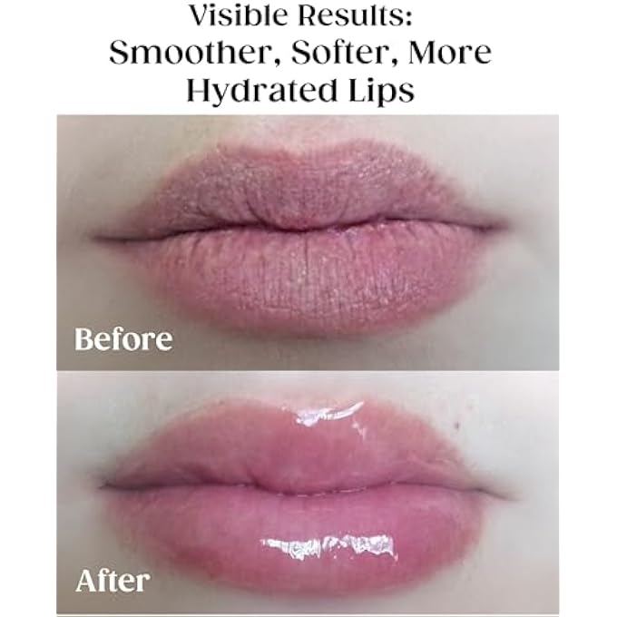 KAPLAN MD PERFECT POUT DUO LIP MASK (0.35 OZ.) & LIP BALM 0.17 OZ. - COMPLETE ANTI-AGING SKIN CARE FOR LIPS - Image 2